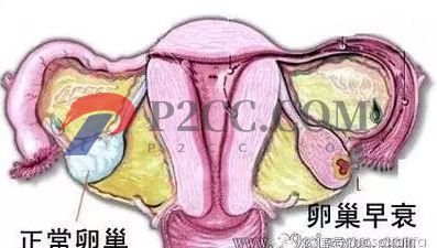女人做了試管嬰兒人就廢了？好可怕，真的嗎？(圖2)