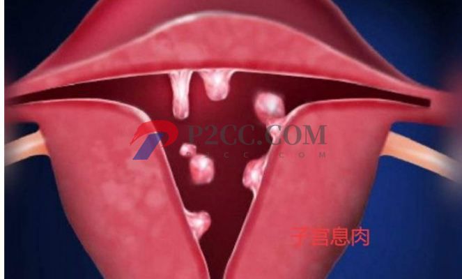 排卵期性腹痛和出血是怎么回事，需不需要治療？(圖2)