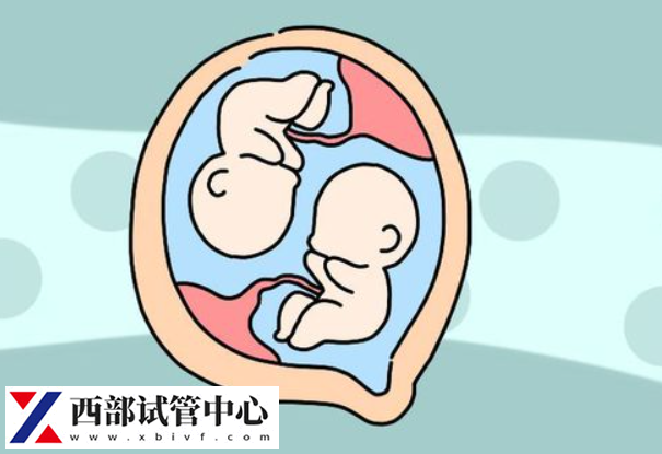 雙胞胎流產(chǎn)的風(fēng)險(xiǎn)略高于單胎