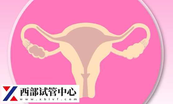 1期子宮內(nèi)膜異位癥患者通常無(wú)明顯癥狀